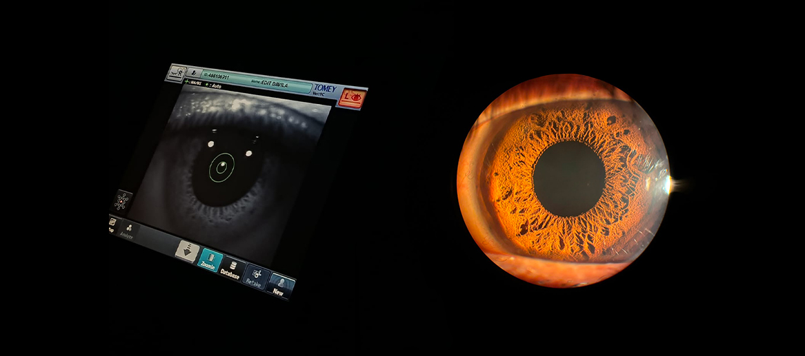 Imagen de estudiante de Optometría realizando prácticas de salud visual, lampara de hendidura, iluminación difusa, miosis midriasis, líderes en optometría, el Instituto San Fernando en Lima